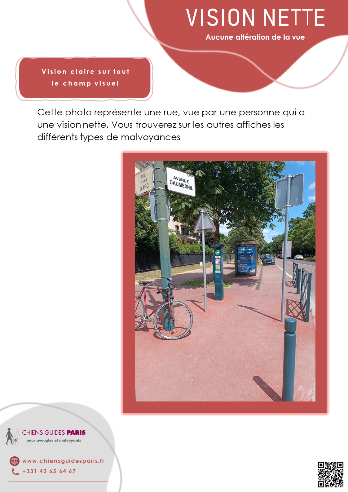 Description de la vision nette