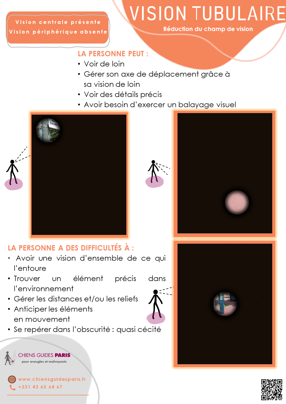 Description de la vision tubulaire