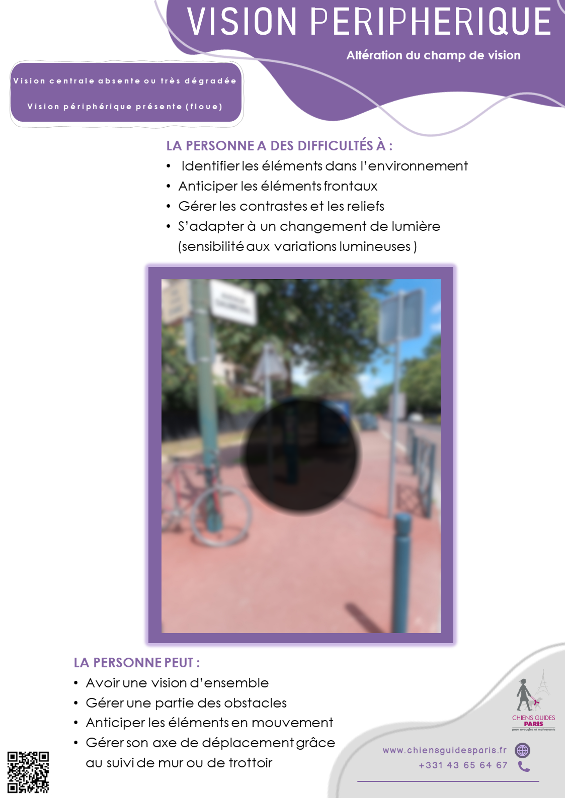 Description de la vision périphérique